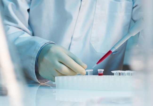 Researh-grade Adenoviral Vector Production Services